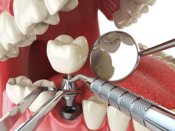 Best Emergency Dentist for Special Needs Patients in Orleans, IN